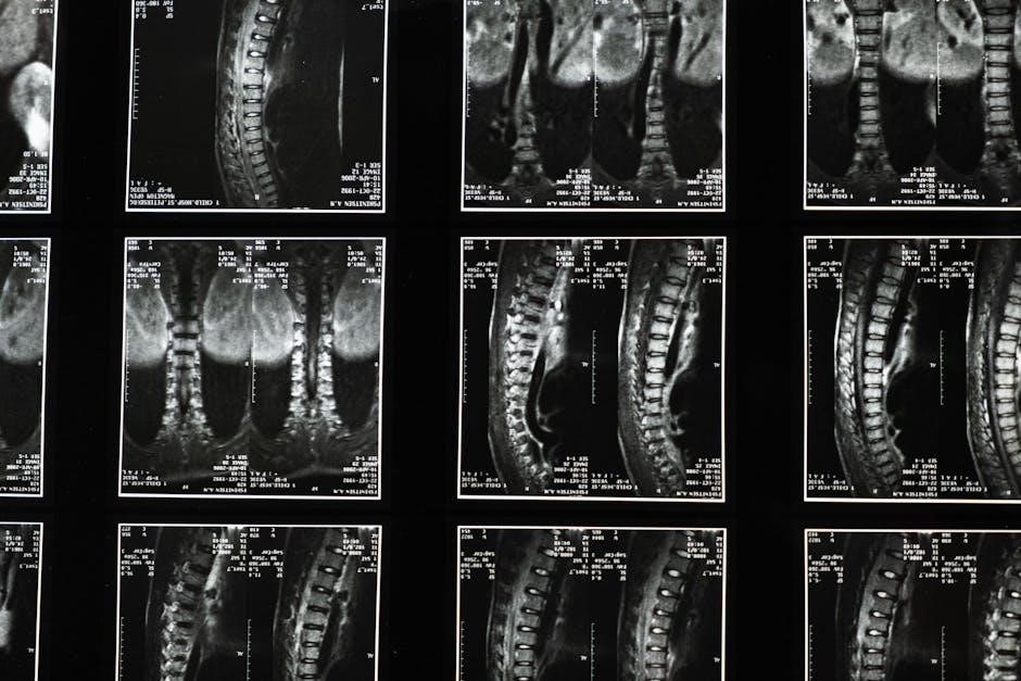 nevro spinal cord stimulator instructions nevro spinal cord stimulator instructions